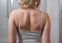 ‘Chip da Beleza’ preocupa médicos e pode causar até AVC