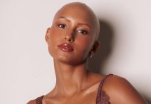 Modelo que nasceu sem cabelos desmistifica a alopecia